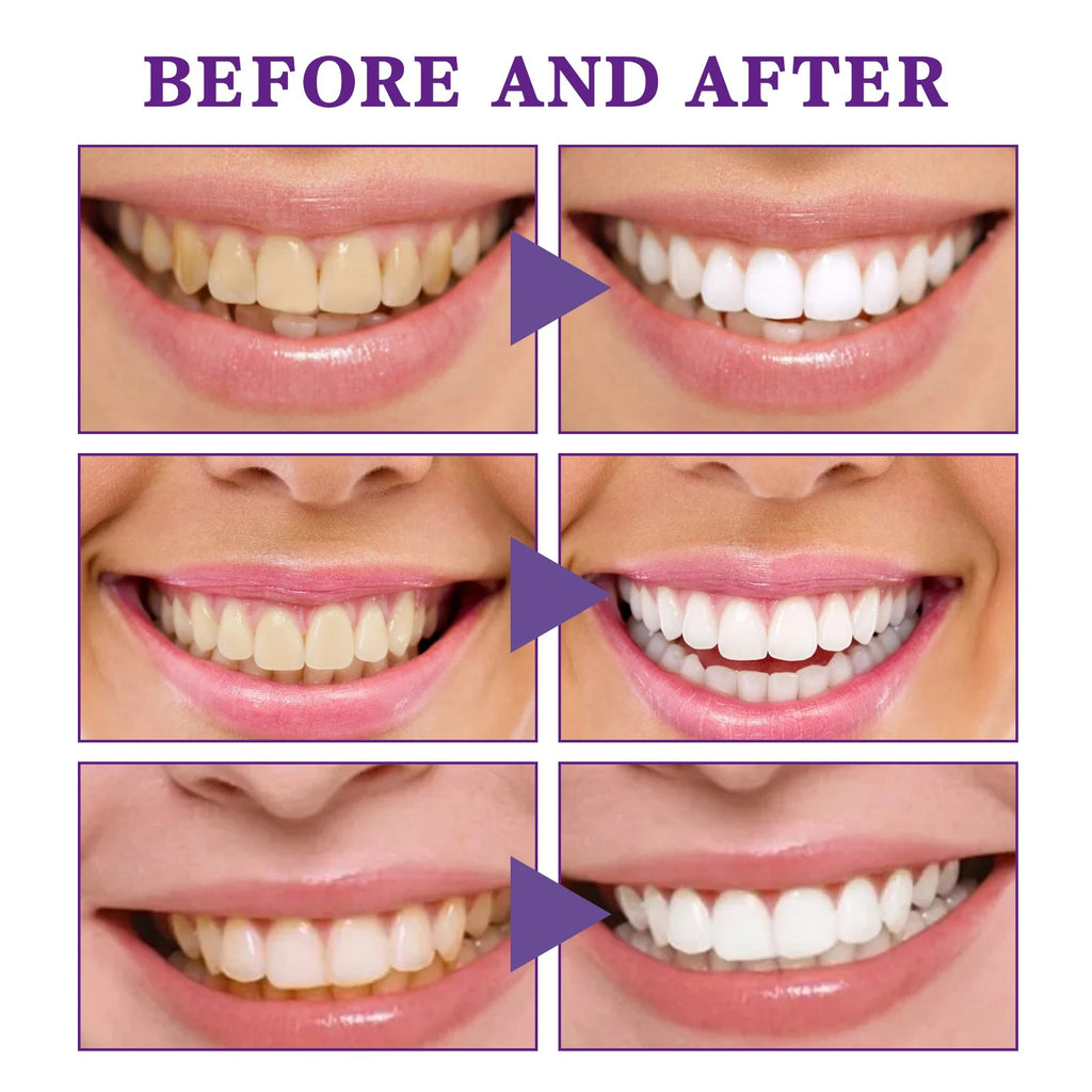 V34 Purple Teeth Whitening Mousse